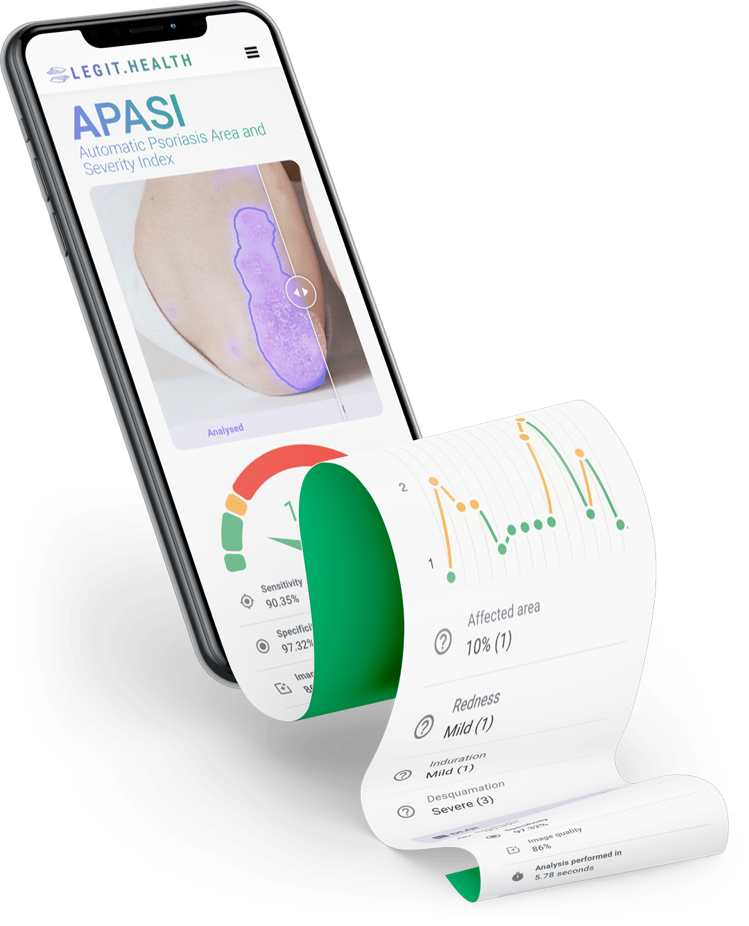 Automatic PASI for psoriasis