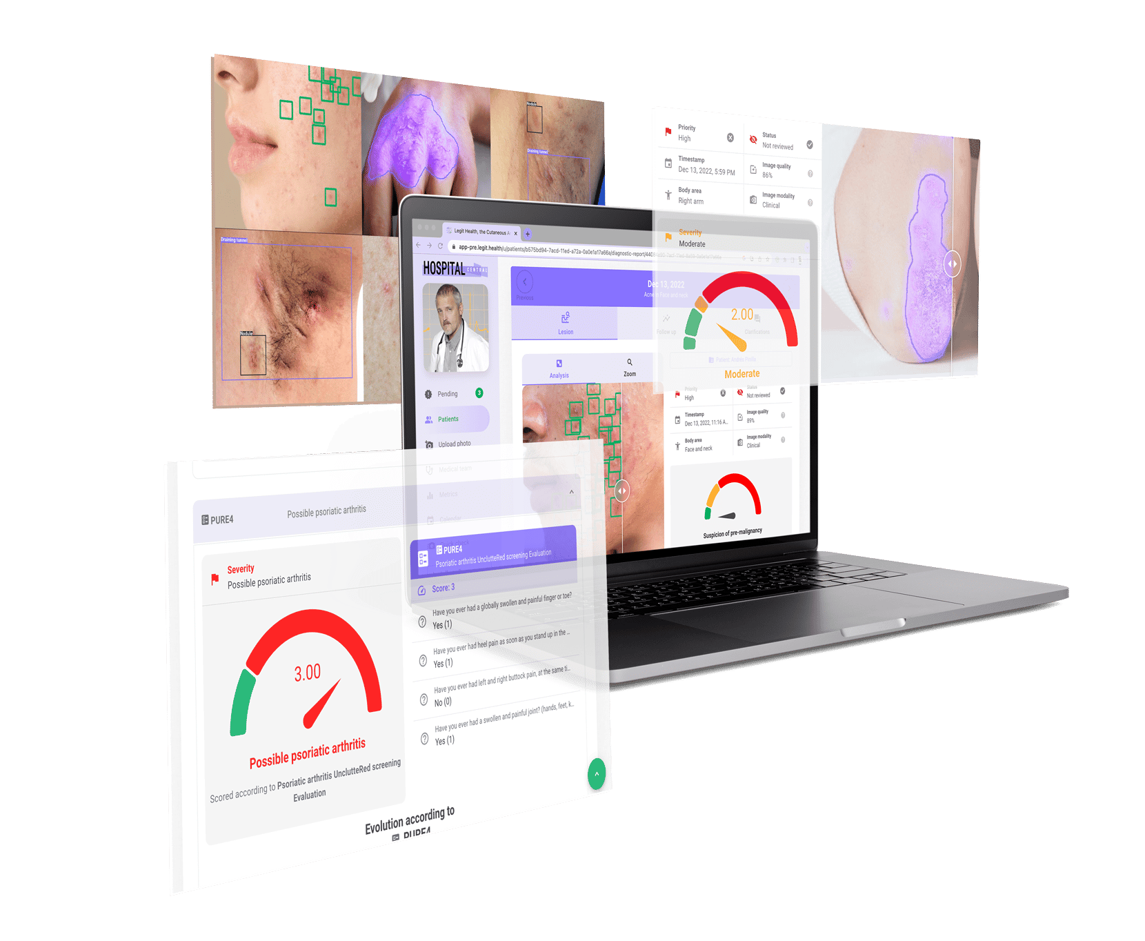 The best dermatology artificial intelligence for doctors