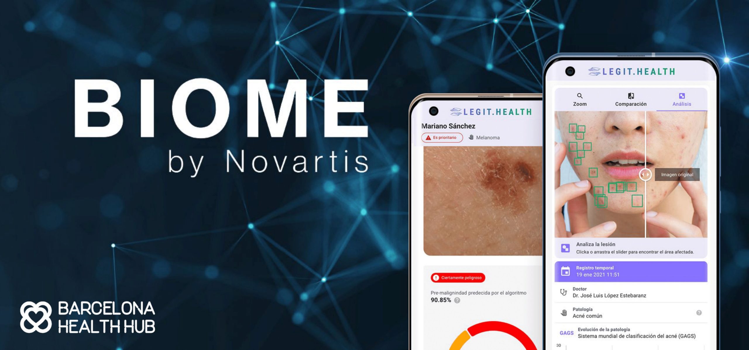 Novartis