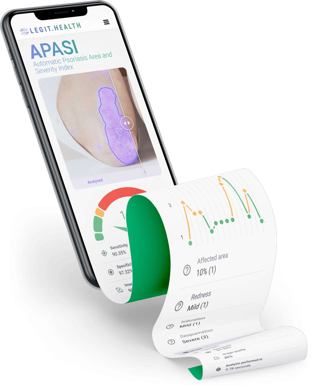 Automatischer PASI für Psoriasis