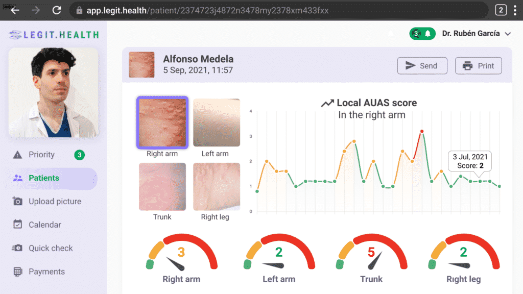 Automatic Urticaria Report