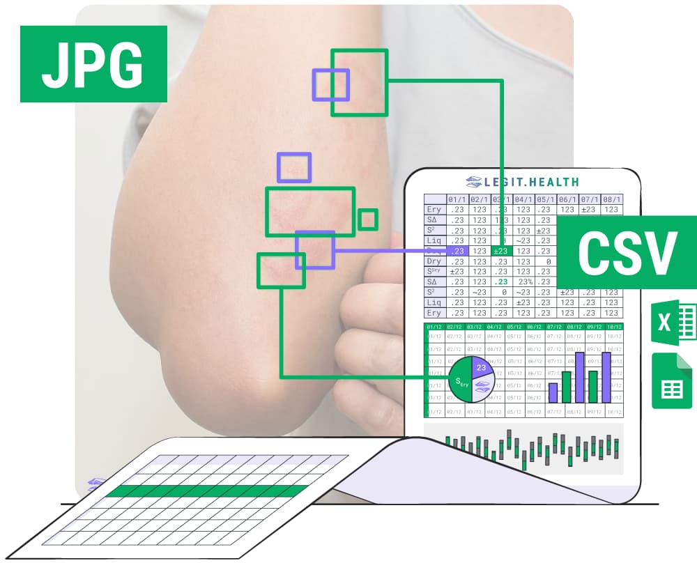 Visuelle Erläuterung der Algorithmen zur Umwandlung von Pixeln in
CSV