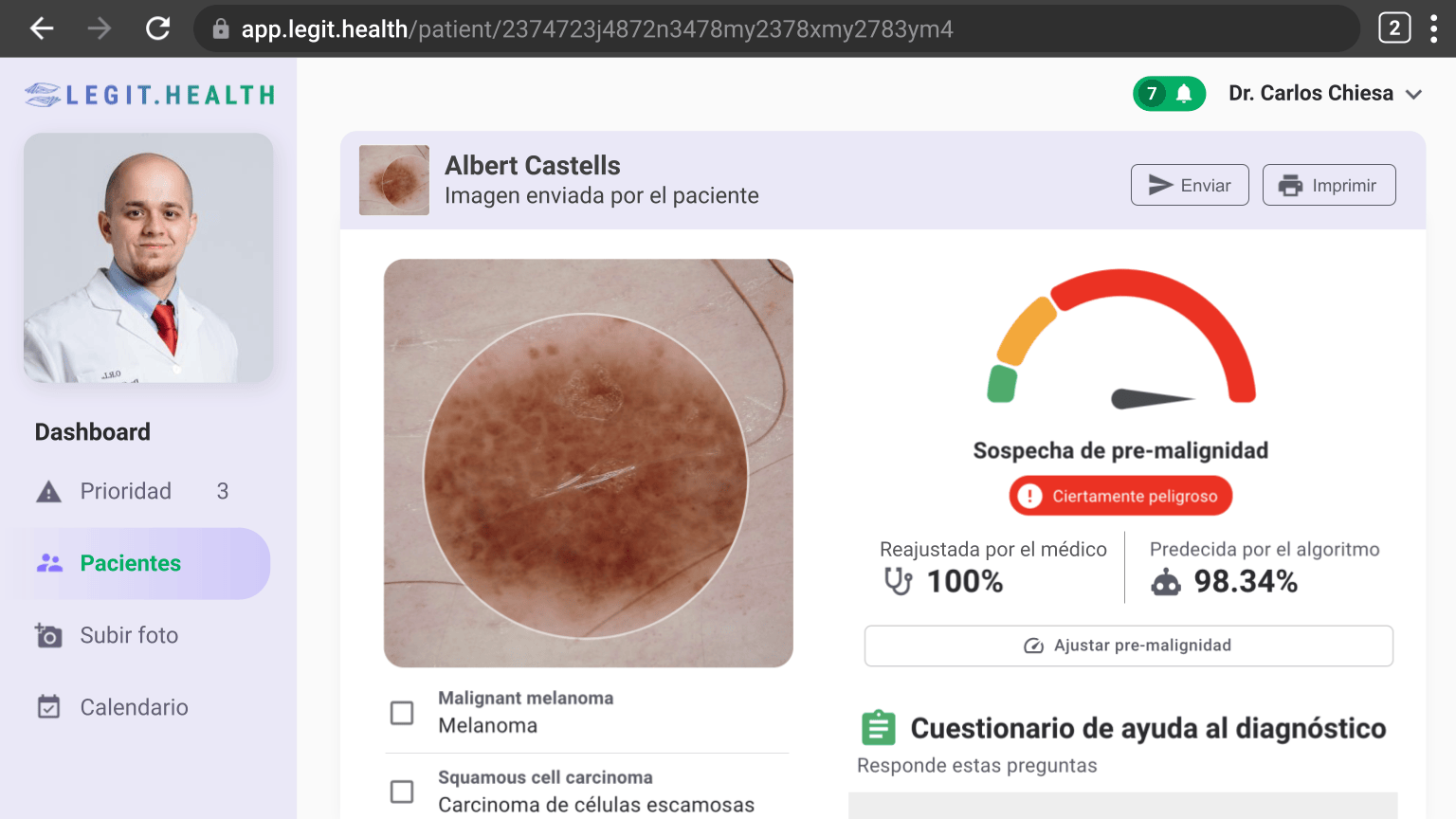 Pre malignancy prediction with artificial intelligence helps primary care doctors and dermatologists alike