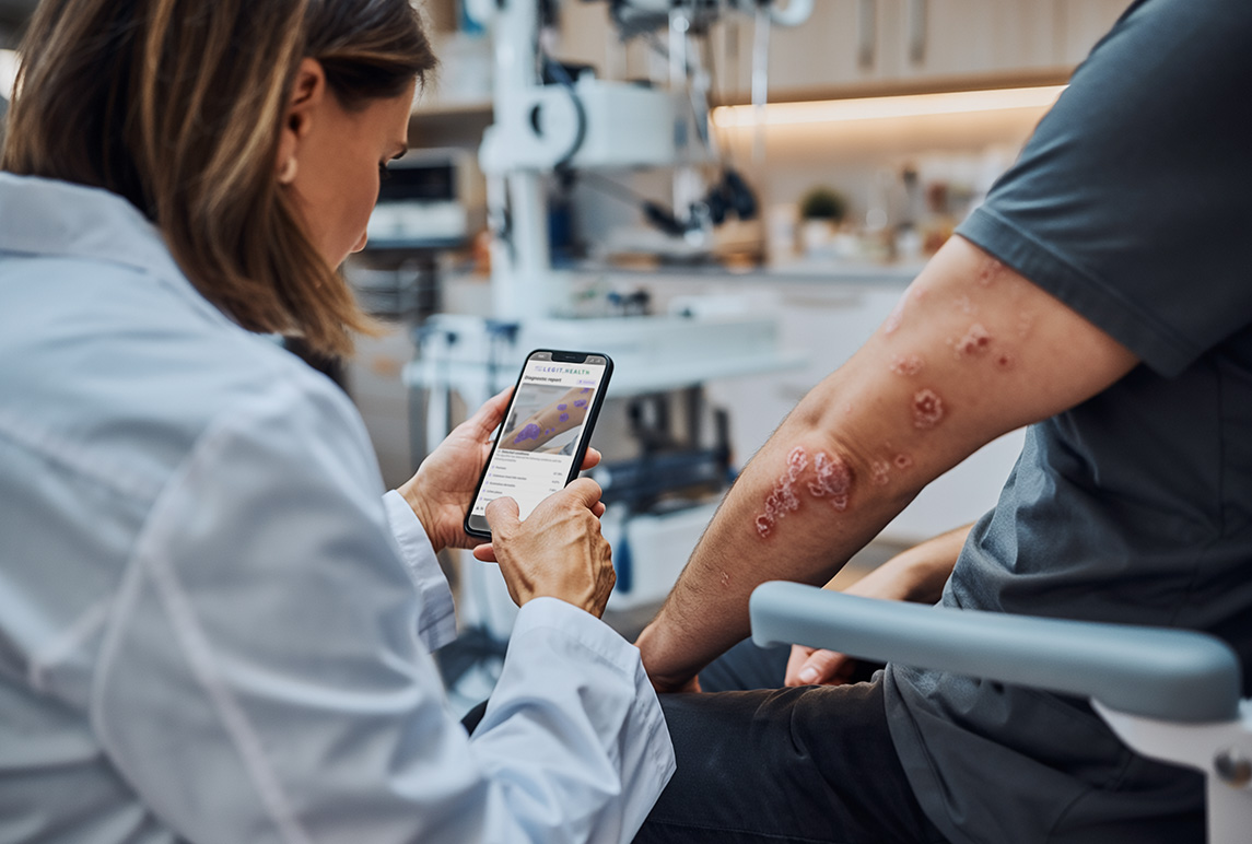 Clinician reviewing a dermatology case on the Legit.Health web interface, with image and severity score side by side