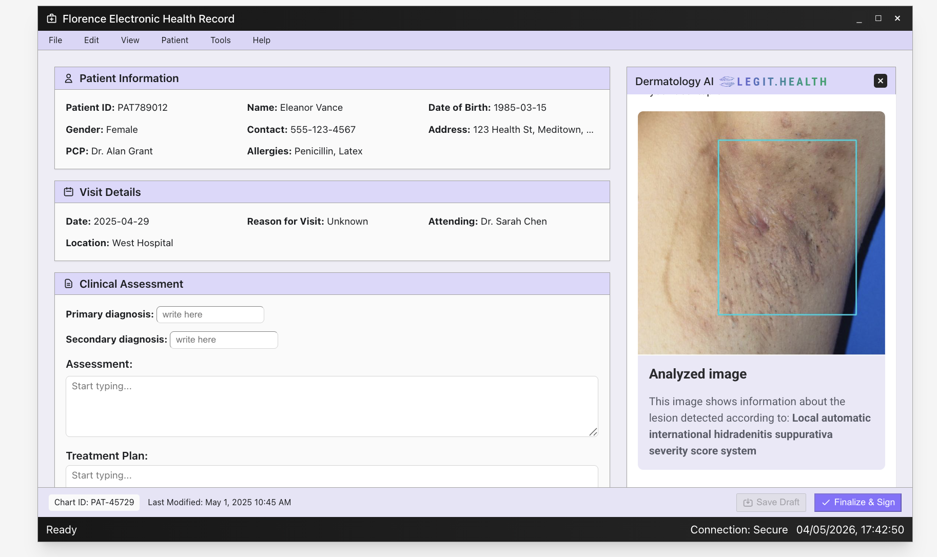 Step 2 — the Legit.Health iframe showing the analysed image with the lesion outlined and an objective severity score.