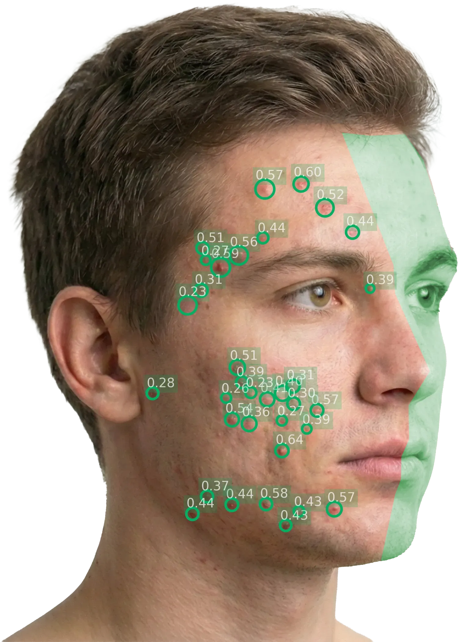 Left diagonal perspective with the excluded right-side region highlighted in green