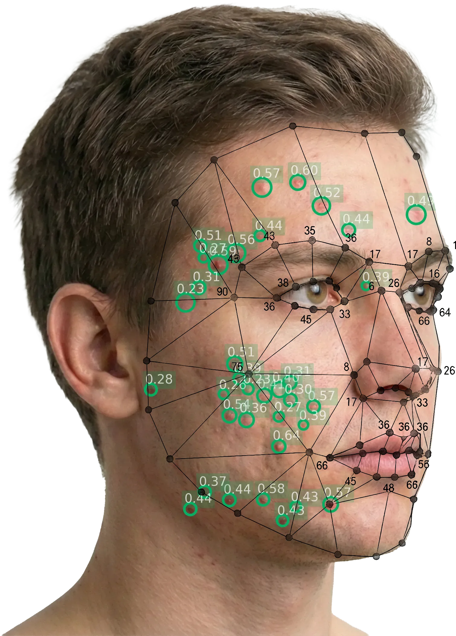 Facial landmark mesh overlaid on lesion detections showing how the AI maps regions