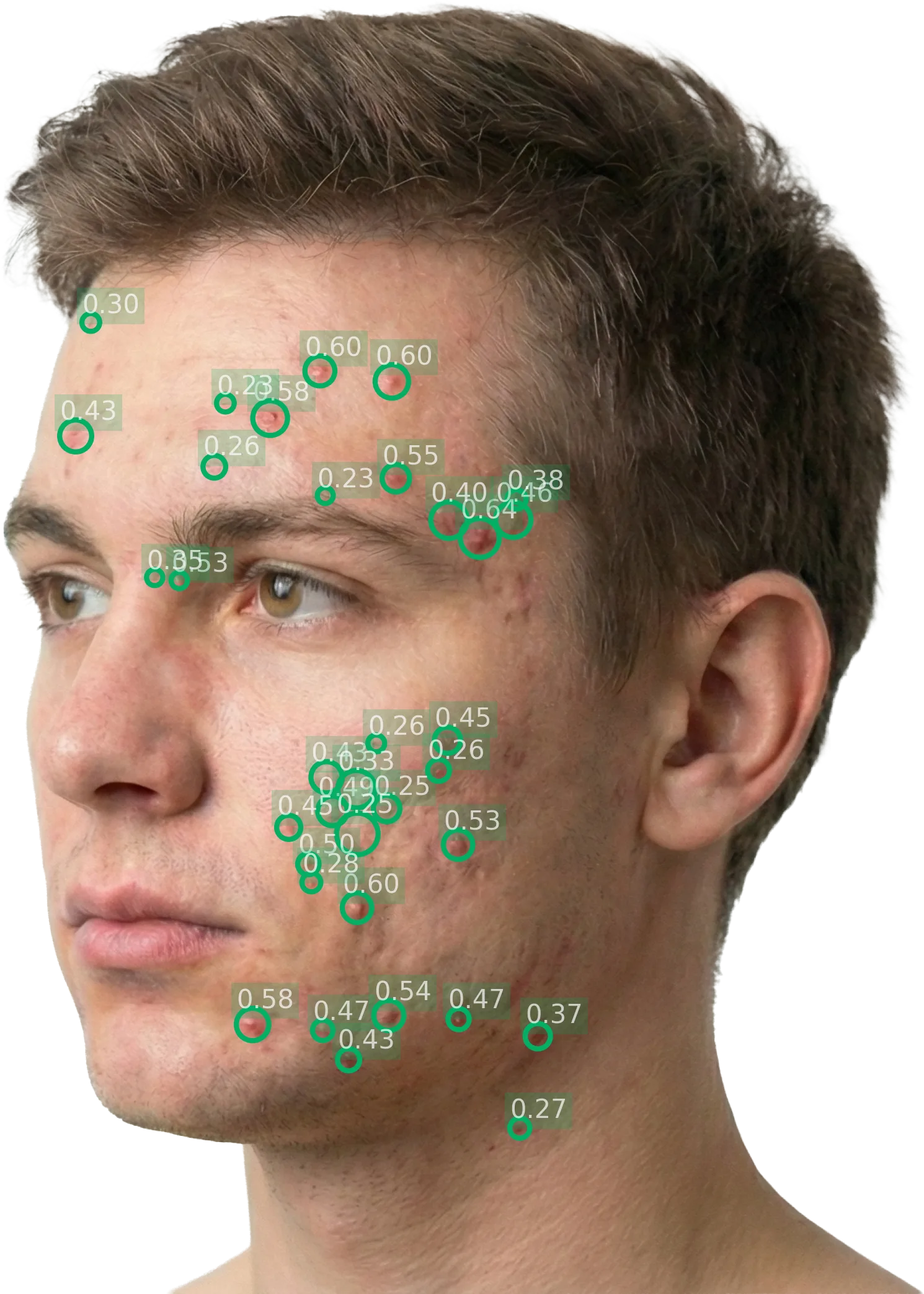 Analyzed Right diagonal