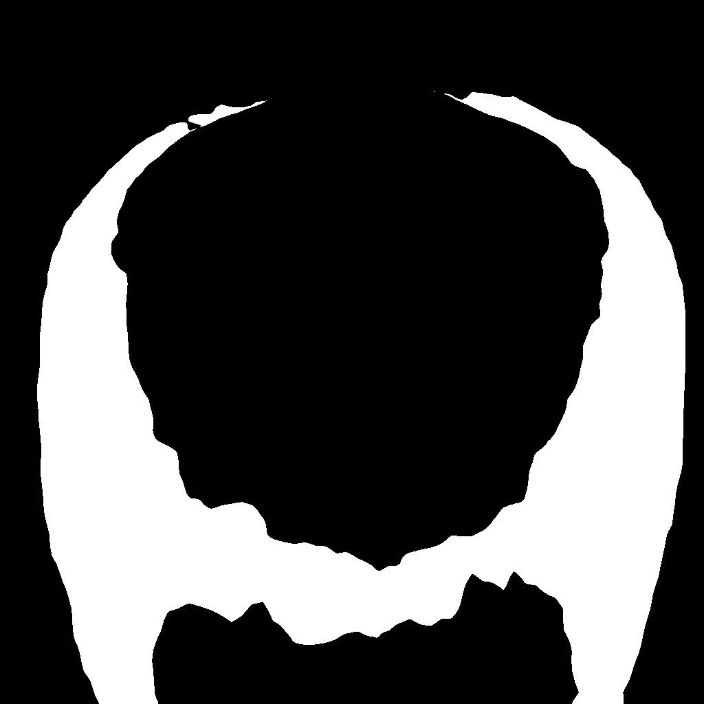Pixel-level hair-loss segmentation mask