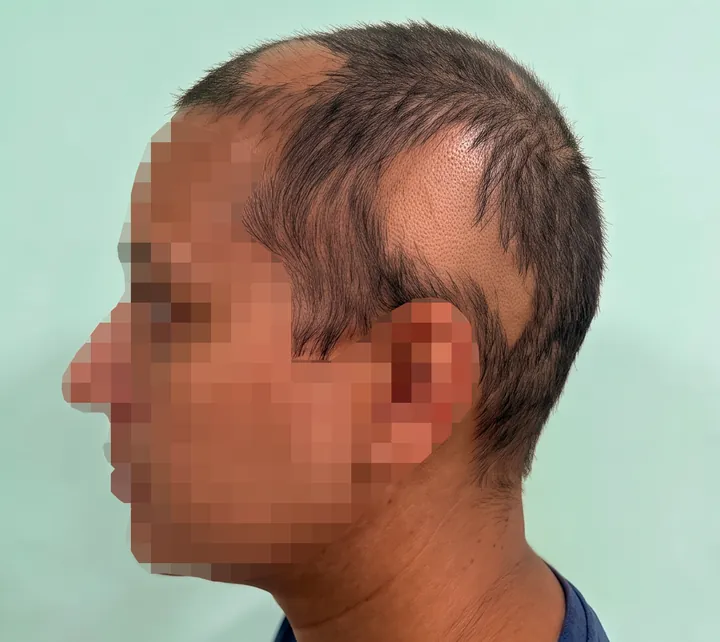The same side view with the hair in its natural position and no accessories