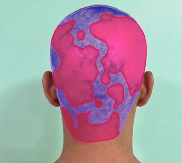 AI segmentation: Back