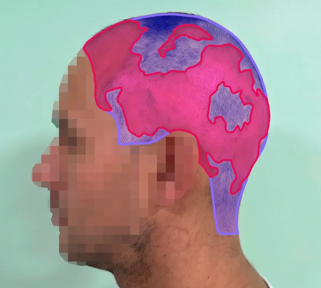 AI segmentation: Left side