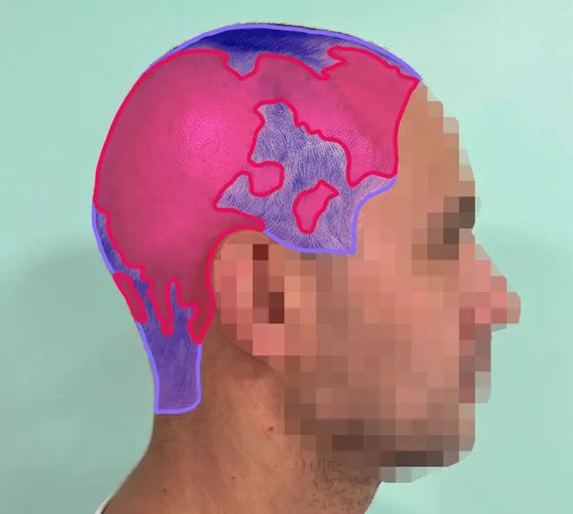 AI segmentation: Right side
