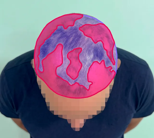 AI segmentation: Top