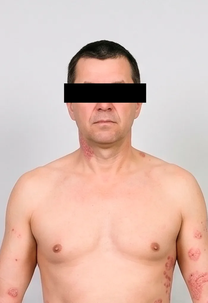 Clinical photograph with the patient's facial features masked for anonymisation