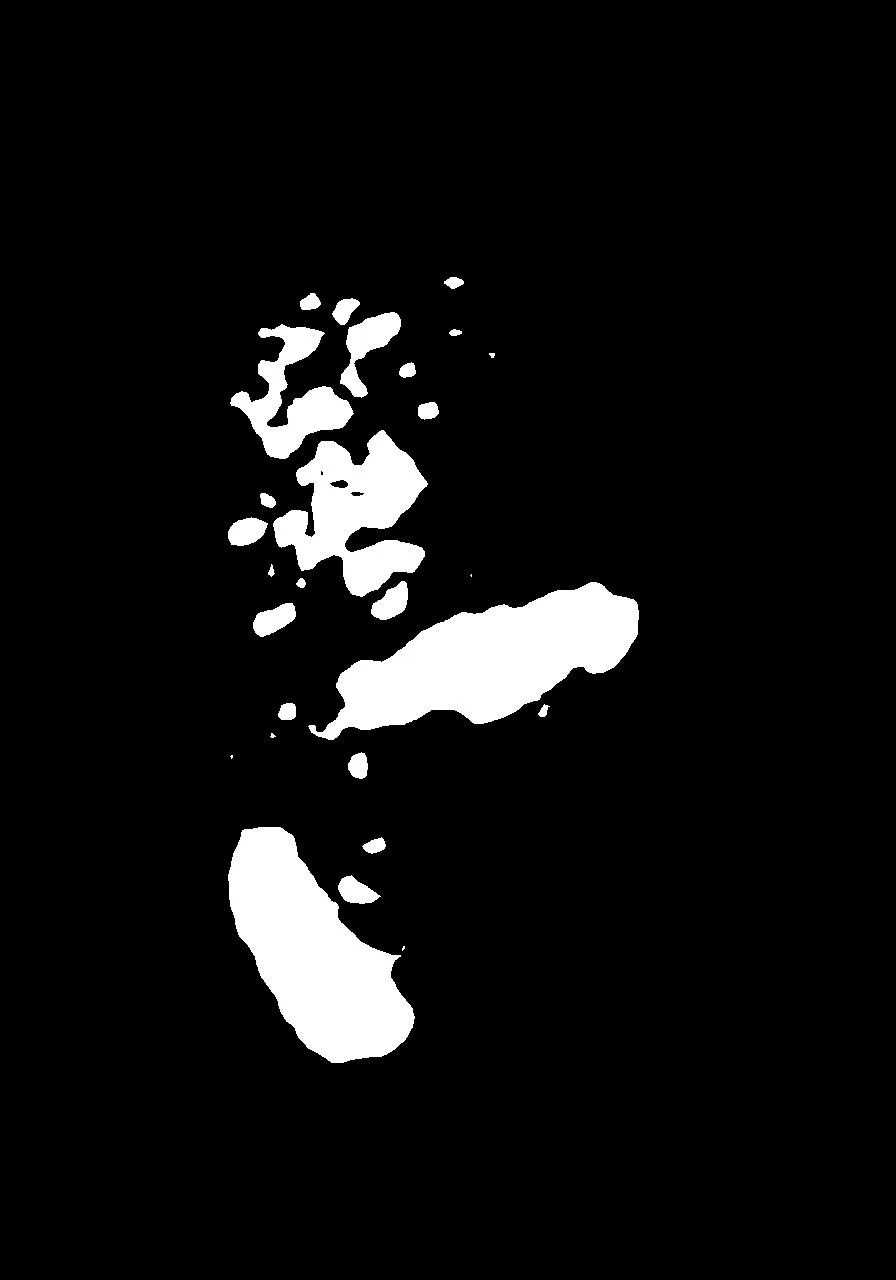 Pixel-level eczema segmentation mask produced by the AI
