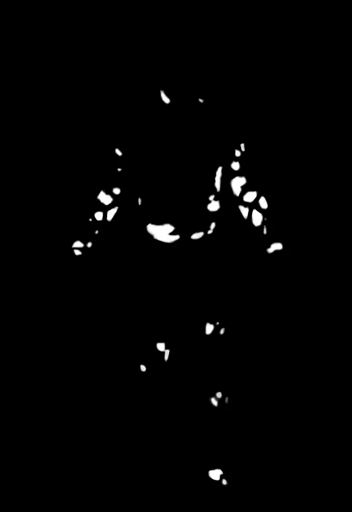 Binary segmentation mask of the affected skin at pixel level