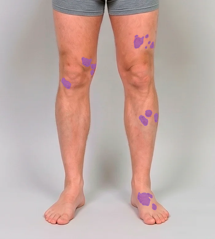 Full-body perspective: Legs, front
