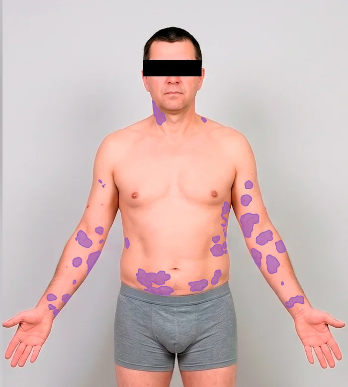 Full-body perspective: Head & trunk, front