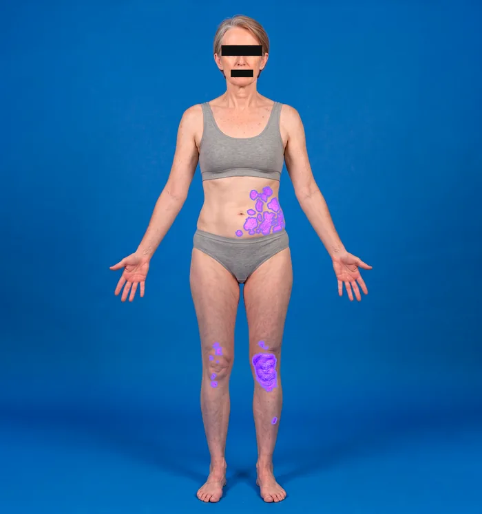 Pixel-level segmentation overlaid on the original photograph