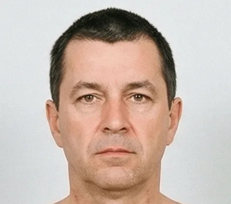 Head, front view