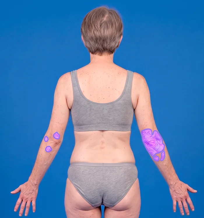 Full-body perspective: Head & trunk, back