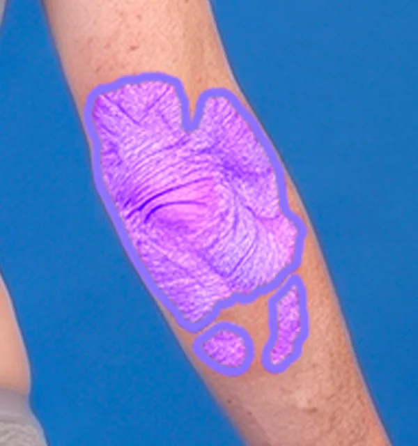 AI segmentation: Upper extremities