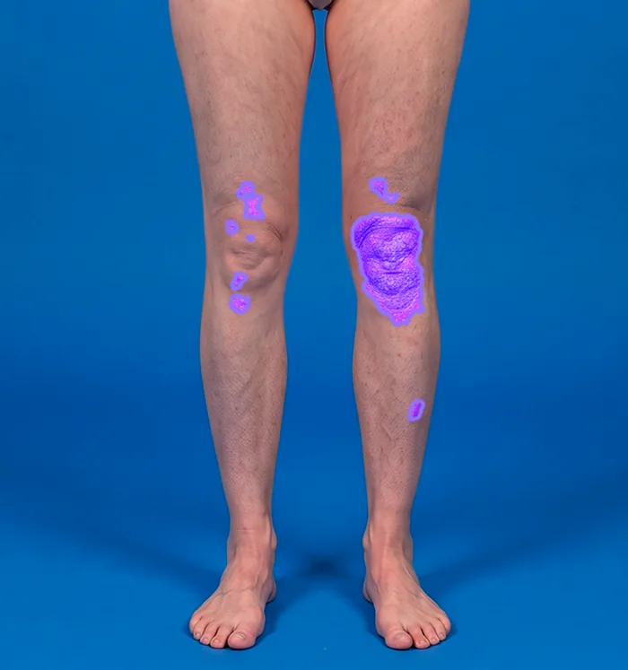 Full-body perspective: Legs, front