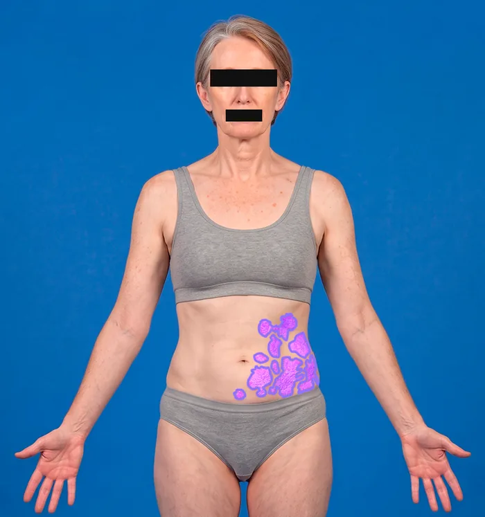 Full-body perspective: Head & trunk, front