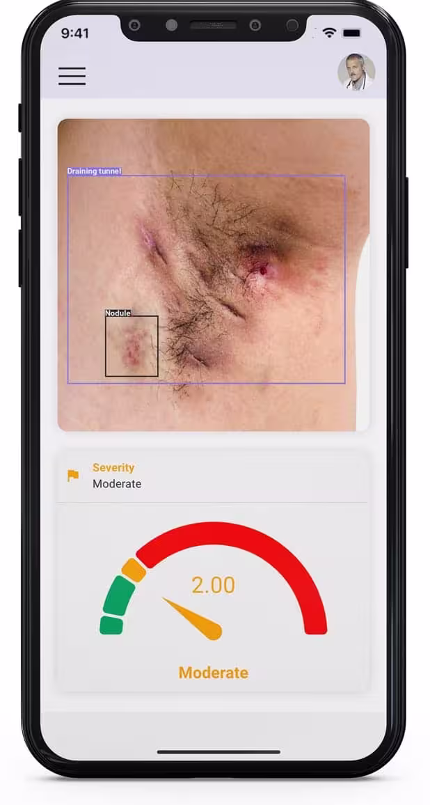 teledermatologia