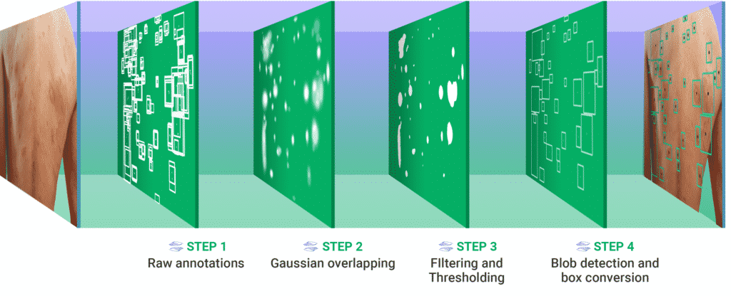 Explicación de la identificación de ronchas