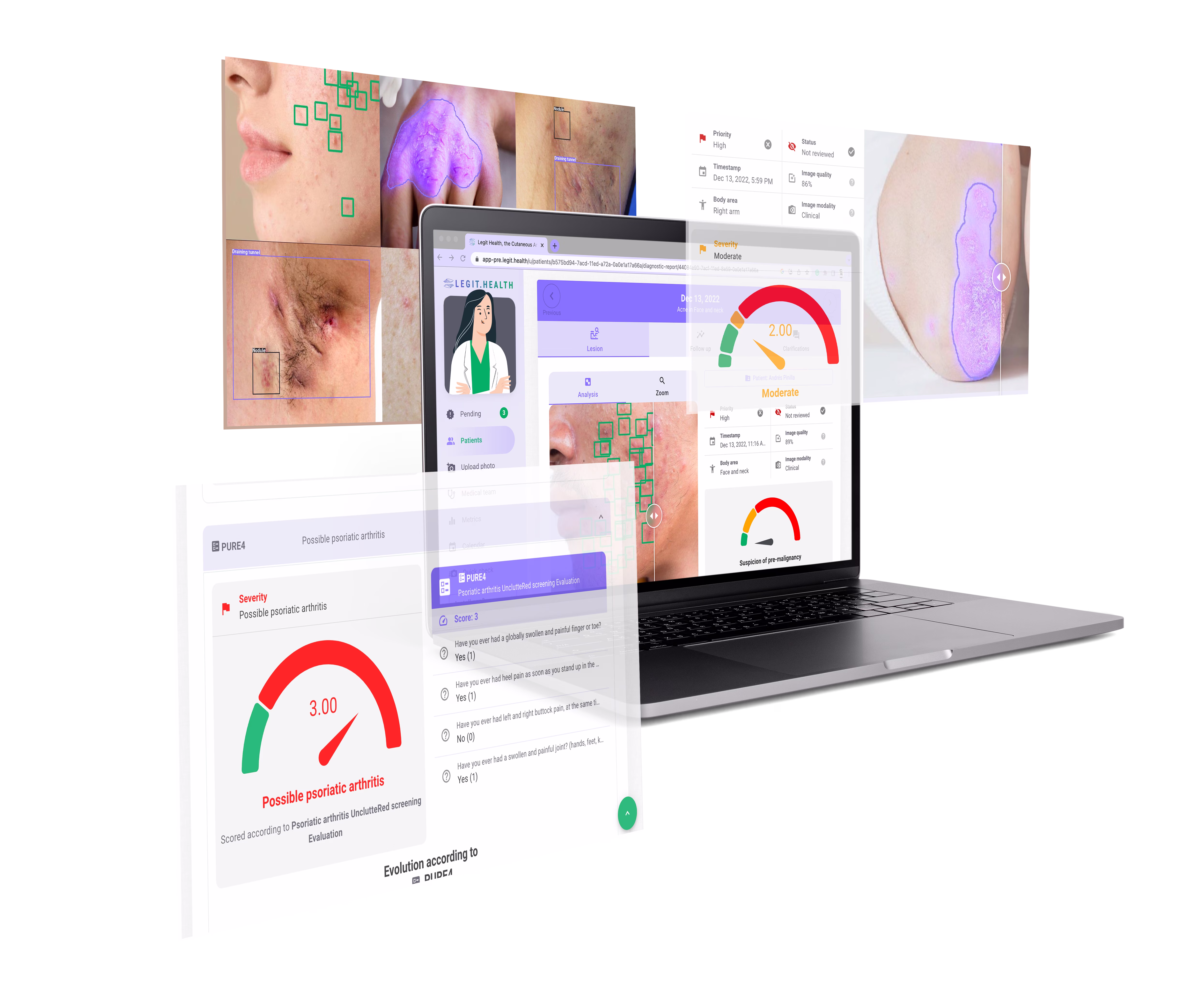 Legit.Health Psoriasis